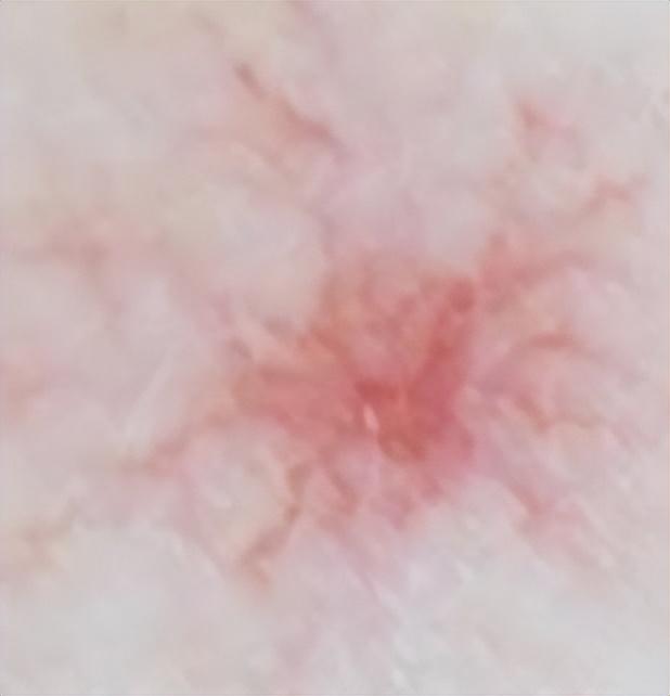 男子身上发痒一查竟是肝癌? 身体4种表现, 当心是肝脏求救信号!