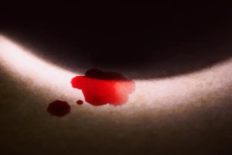 一个15岁的女孩，妈妈在服装厂打工，突然胃出血进了医院。医生说要马上手术，先交8