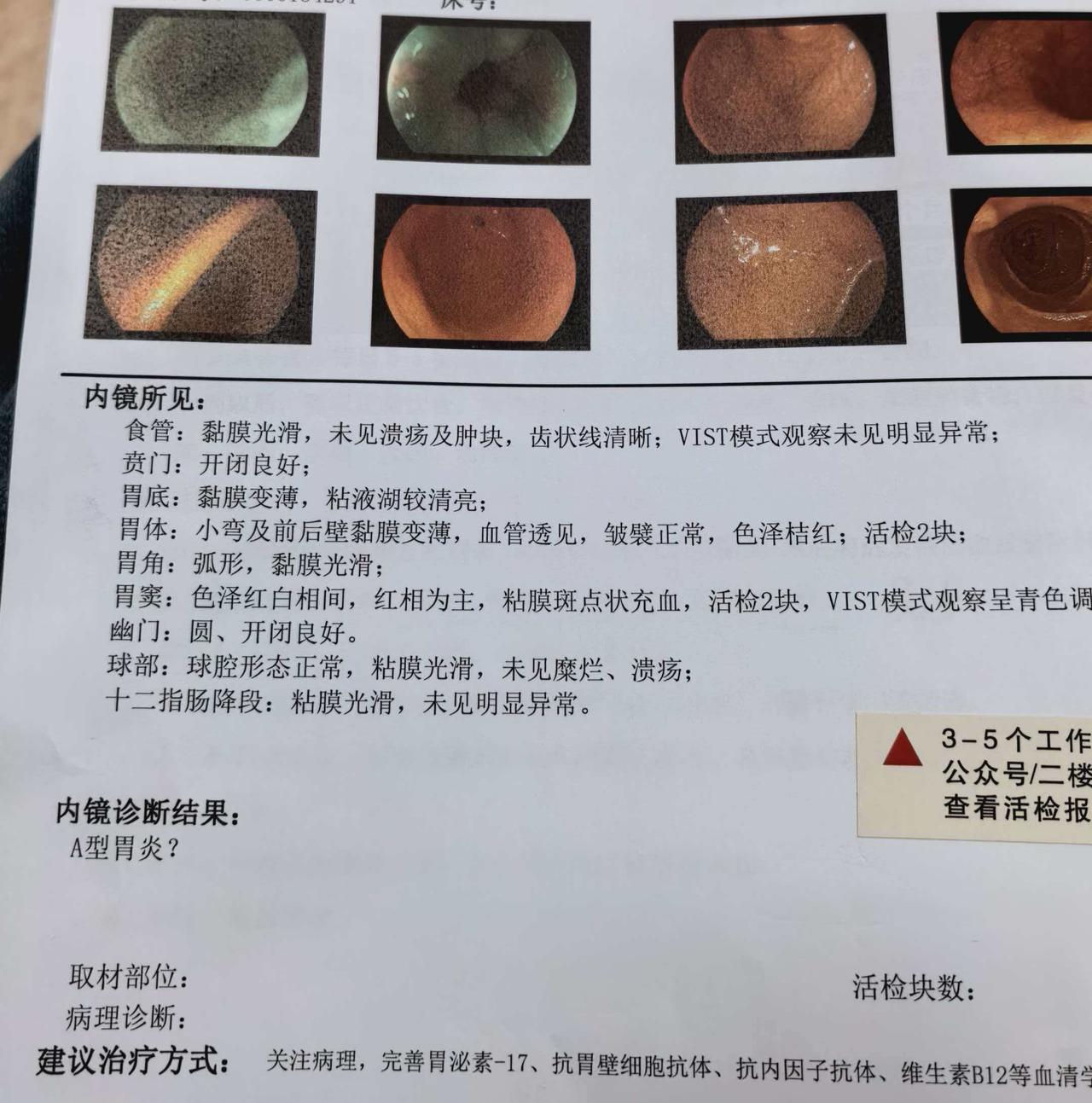 老公也是从未做过肠胃镜检查，只是每天大便几次，我劝过他N次了，都是以各种借口明日