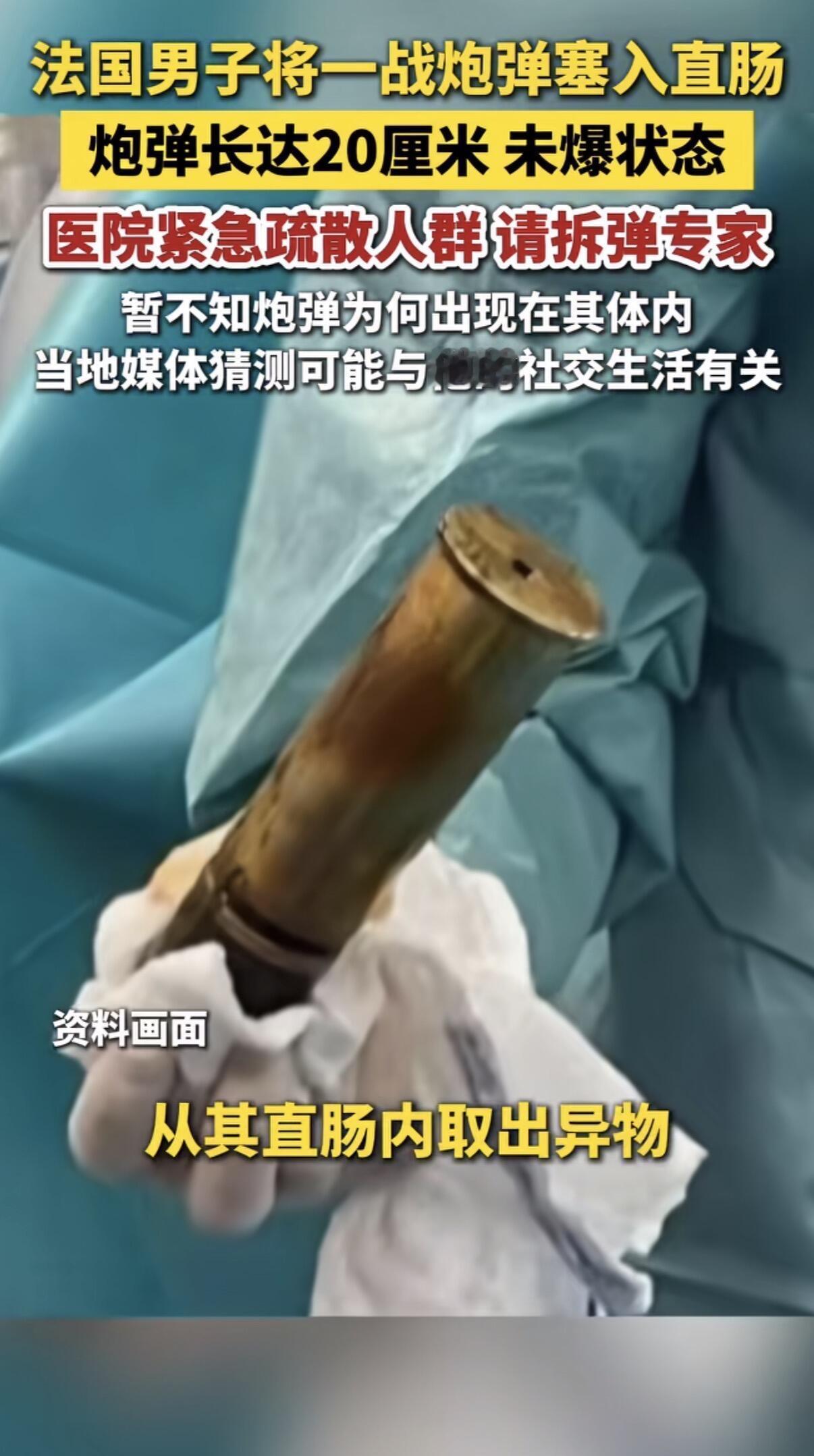 活久见啊朋友们！我以为我这辈子看过的离谱新闻够多了，结果24年的法国给我整了个大