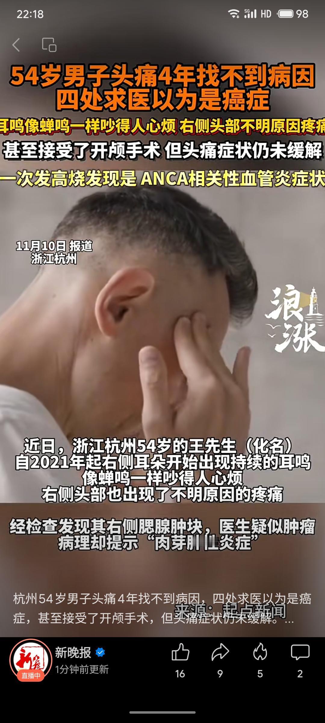 杭州一名54岁男子持续四年右侧头痛、耳鸣，曾被误诊为肿瘤甚至接受开颅手术，但症状