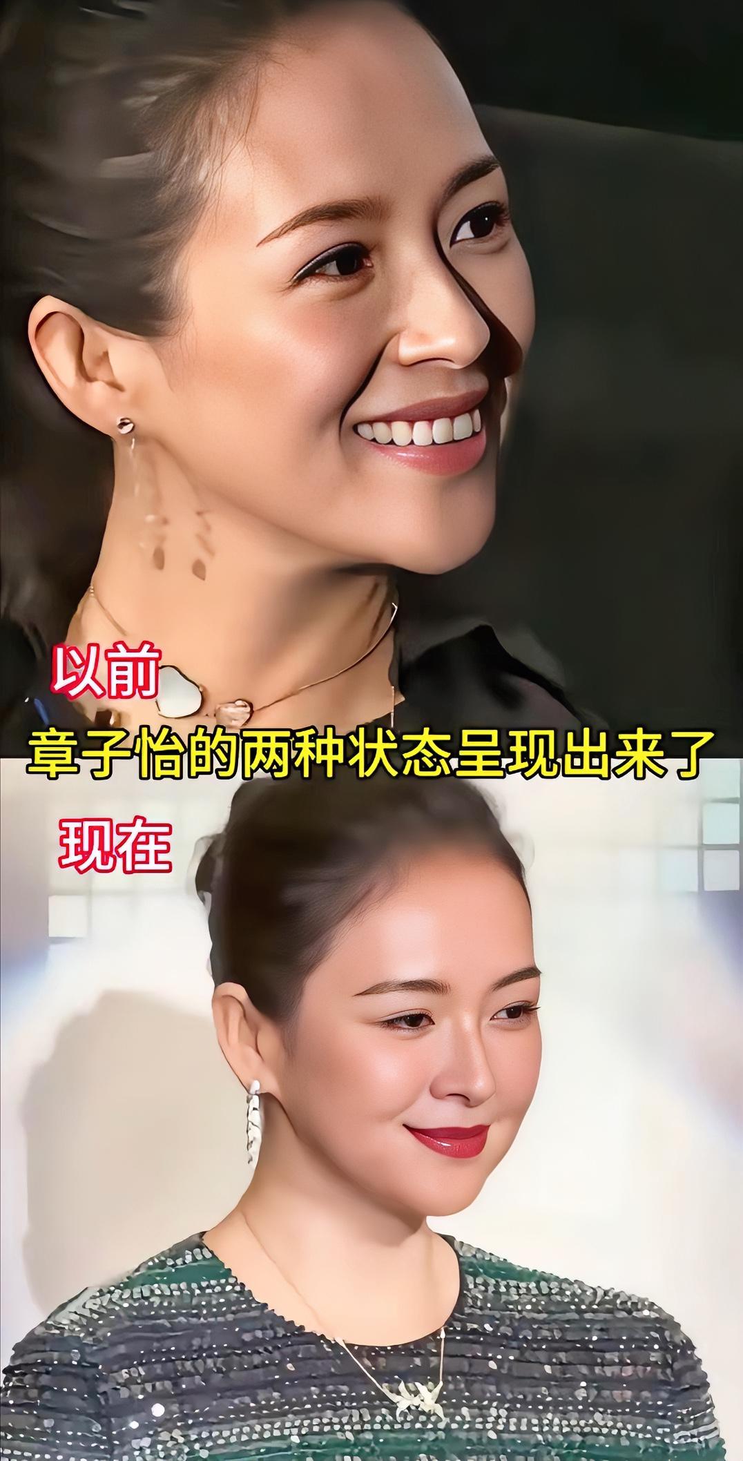 最近网上都说章子怡改头换面，整容到都不认识了。仔细看看她近期照片，确实跟以前有些