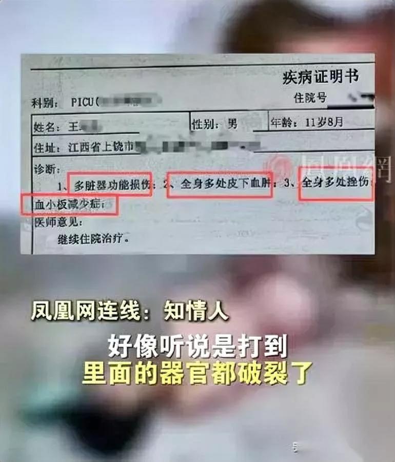 11岁，6小时。孩子只剩一句“想回家”。我盯着那张ICU照片，后背全是淤