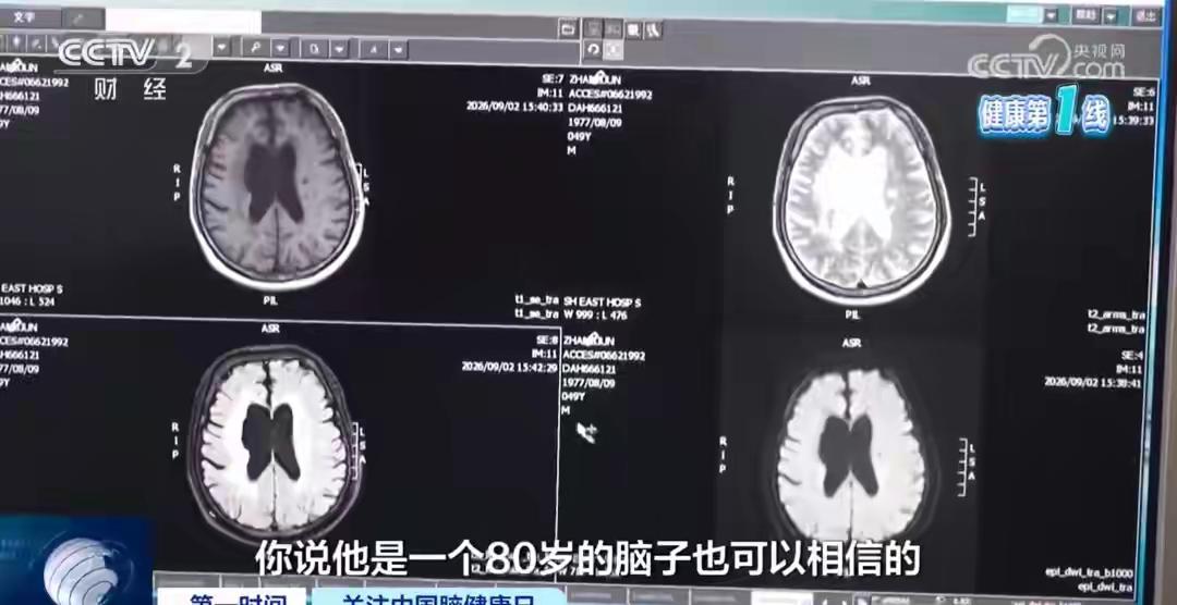 上海，一49岁壮年男子，因咱几乎每天都在做的习惯，竟然把自己送进了医院，确诊为“
