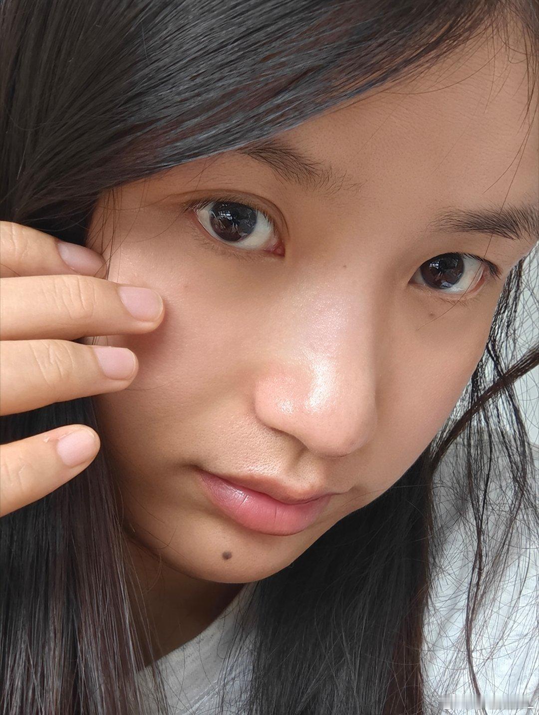 猫爪子居然这么毒的吗？昨天去抓猫，脸上被挠到了一点，感觉周边都有点红肿痛了...