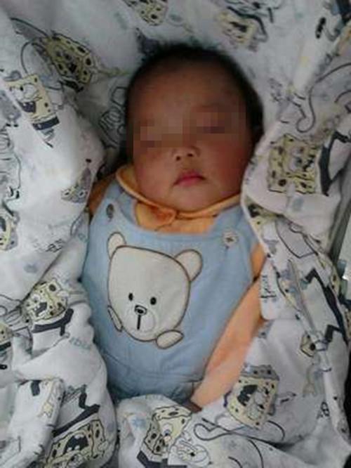 8个月宝宝变“香肠嘴”送医急救, 医生: 你怎么什么都给孩子吃?
