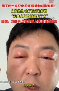 这就是嘴馋的后果！5月4日江苏常熟，一男子在家做小龙虾，将虾线和虾头处理好后，就