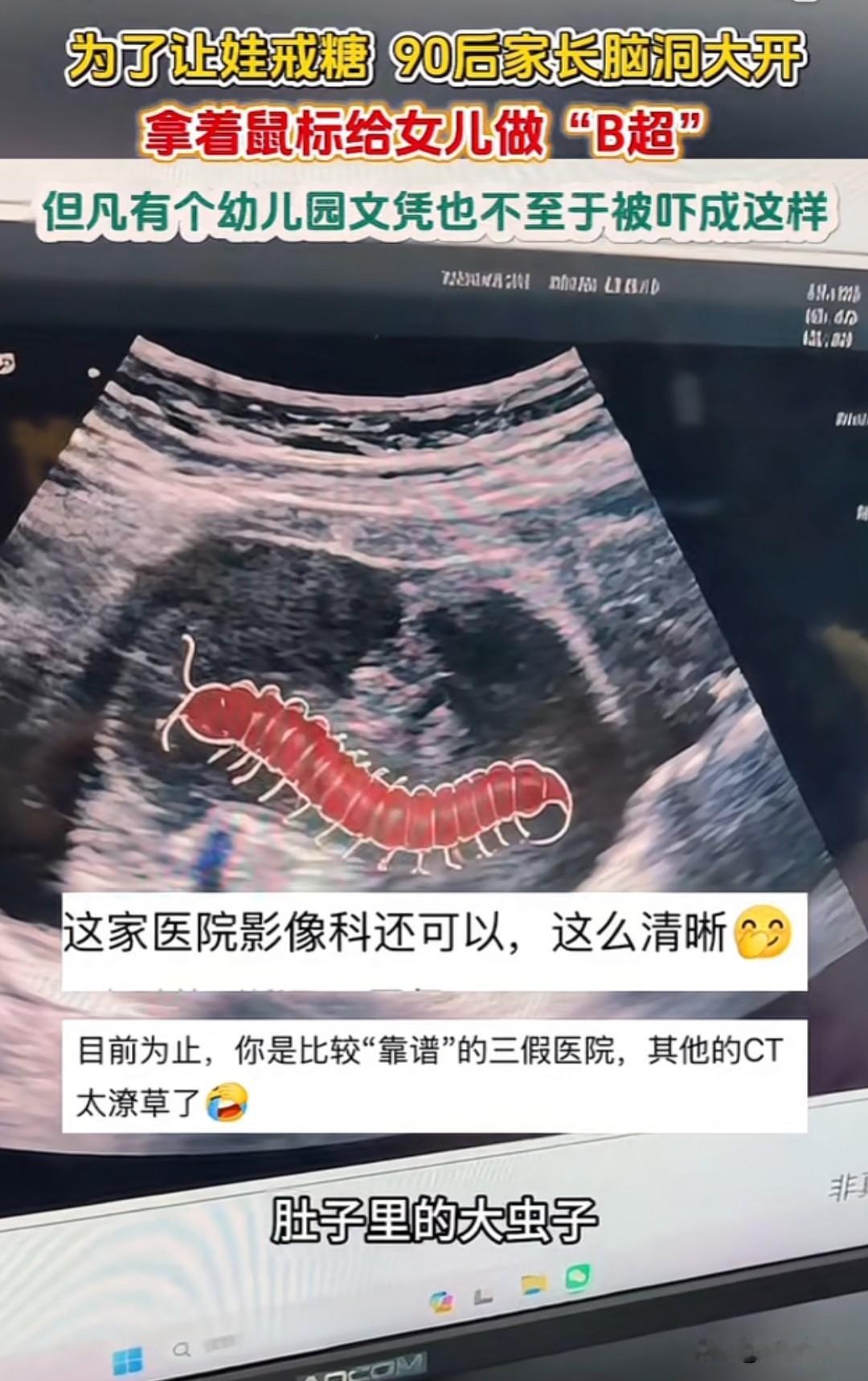 近日，江西南昌，90后家长为了帮小丫头戒掉疯狂爱吃糖的毛病，南昌这对90后爸妈脑