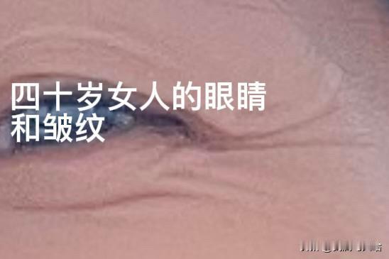 猜猜这是多少岁人应该有的眼角皱纹？还不到四十岁的我眼角竟全是皱纹，正常吗？