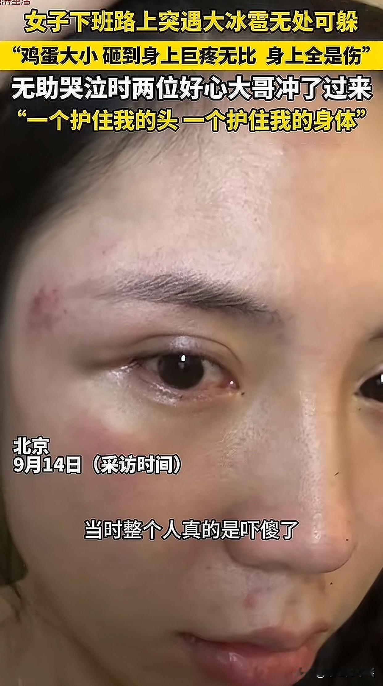 破防了！近日北京暴雨冰雹夜，一女子下班途中突然遭遇鸡蛋大冰雹，浑身被砸生疼，全