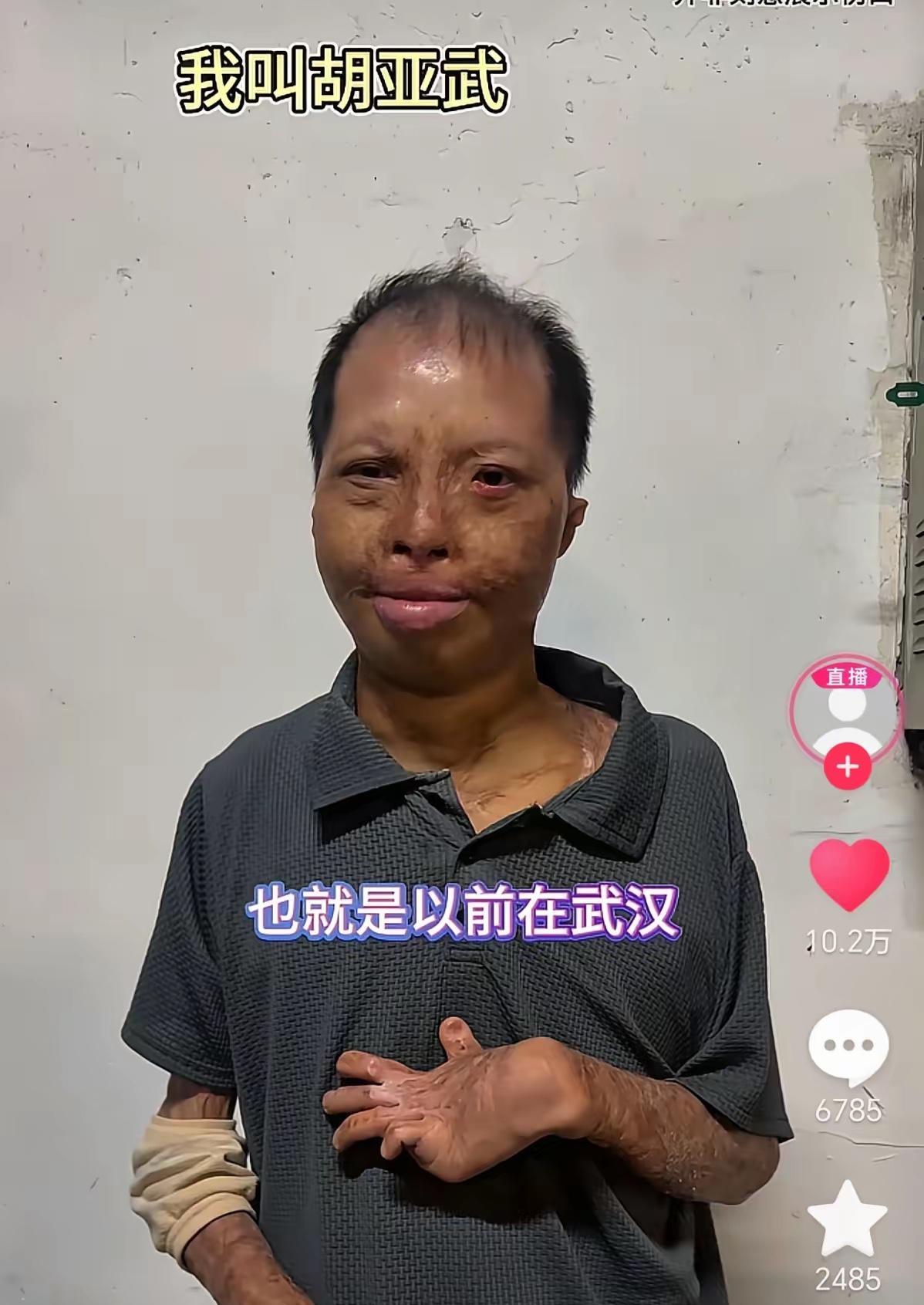 向中国最美男哥手，人民英雄胡亚武致敬！“最美男哥手”这五个字，听起来像选秀节目