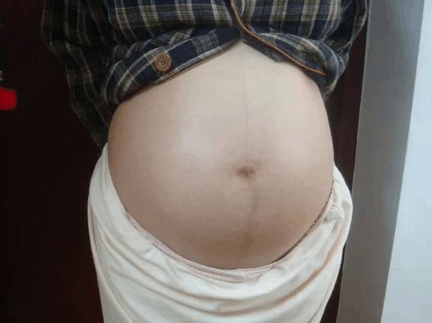孕妇怀孕8个月时, 老公出门不幸遭遇意外, 她做出的决定让人钦佩