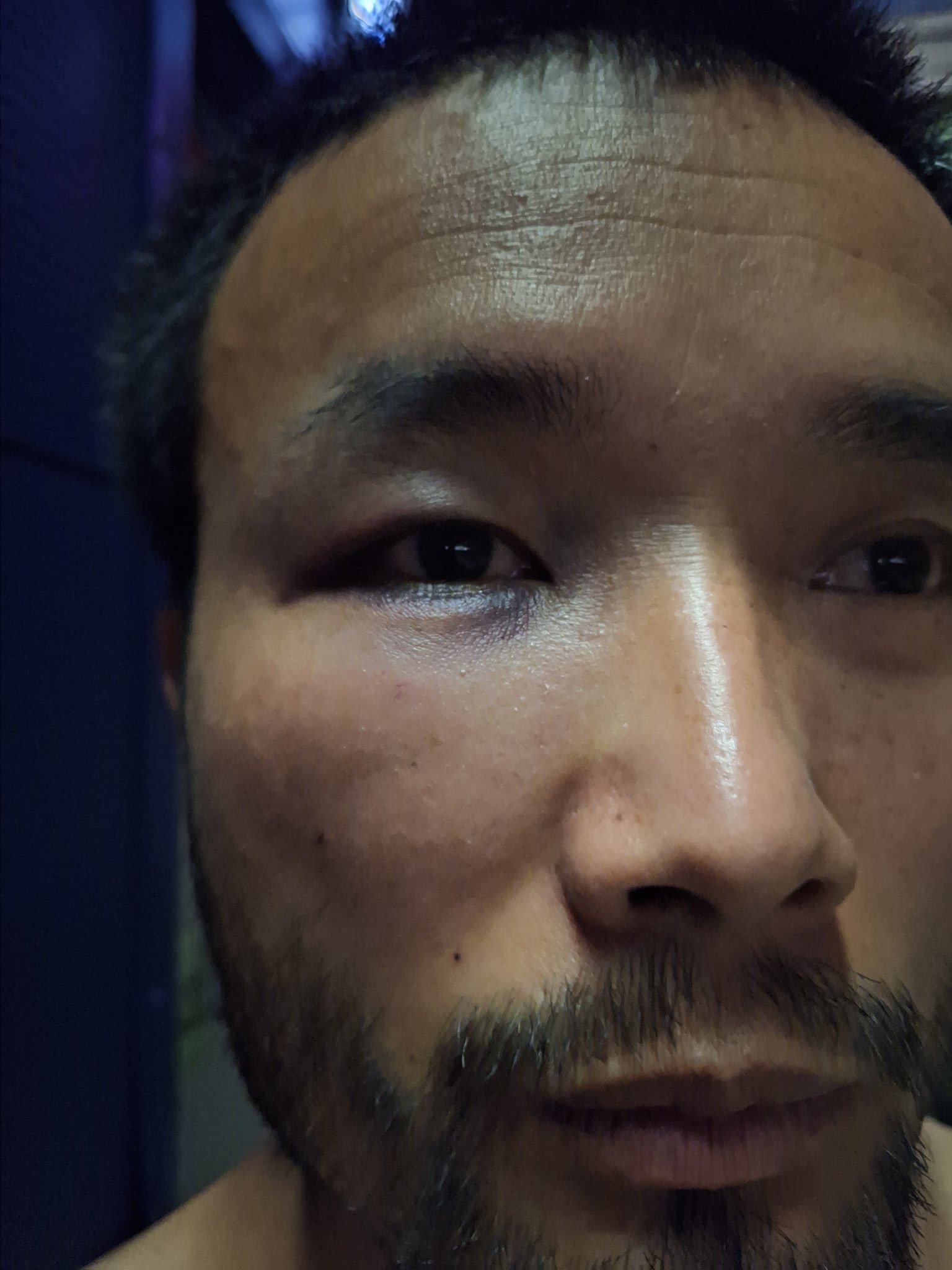 原来陈旺是被皮皮鲁打了。​​​