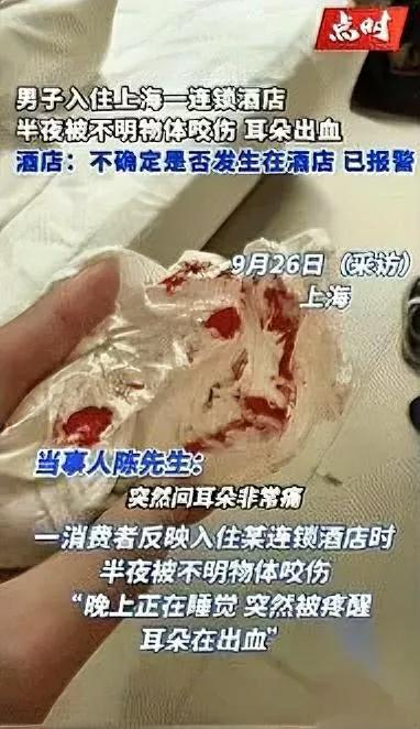 太吓人了！酒店睡觉耳朵突然剧痛开灯后眼前一幕让人崩溃！上海一男子深夜在酒