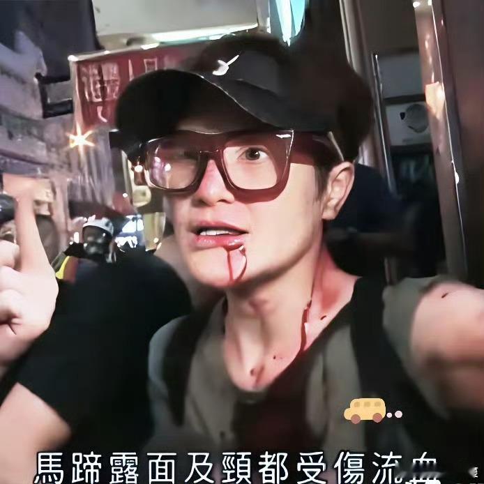 张敬轩的这次洗白无论在内地还是在香港都很失败，骂声一片。确实啊，有好机会为什么不