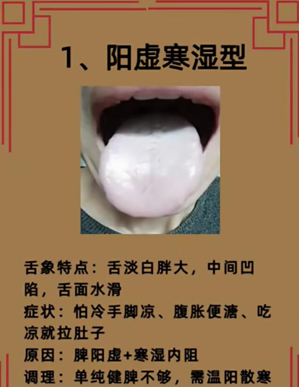 体内湿气总排不干净？三种舌象教你辨别湿气类型
