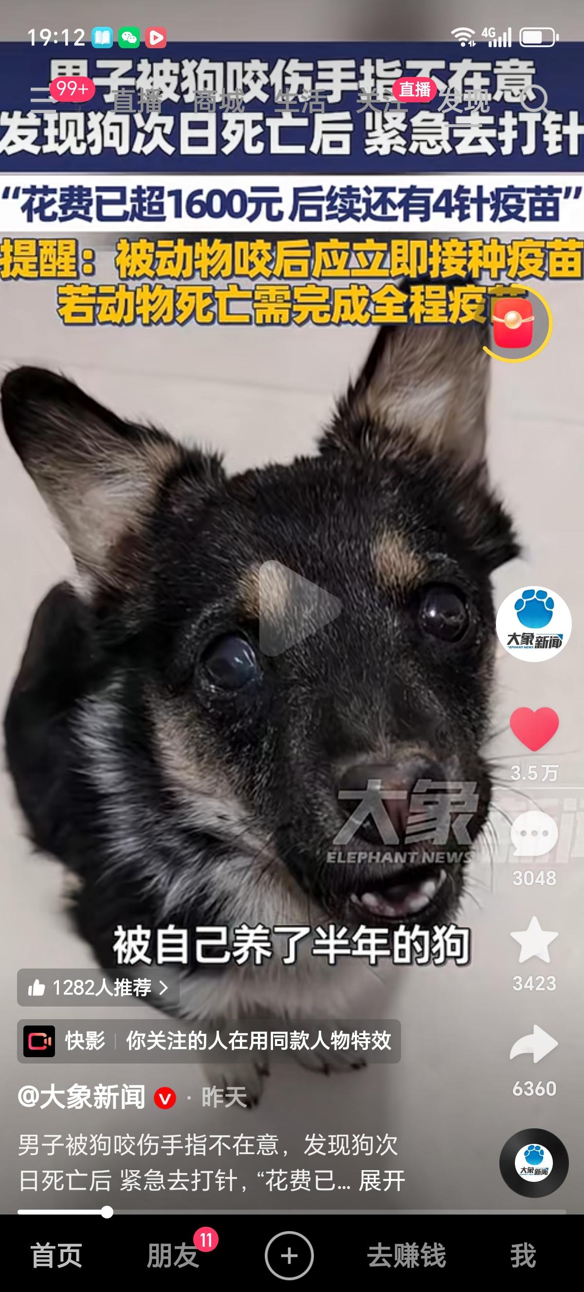 河南周口的李先生被自己养了半年的狗把手指咬伤了，没当回事，也就没有及时处理，结果