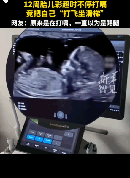 反差感极强！湖南衡阳，一怀孕12周的准妈妈进行例行产检。当进行彩超检查时，屏幕上