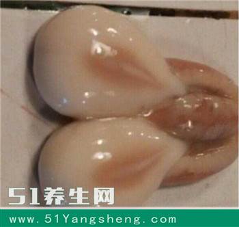 买菜时这东西千万别扔掉! 这种美味想吃要积攒个把月