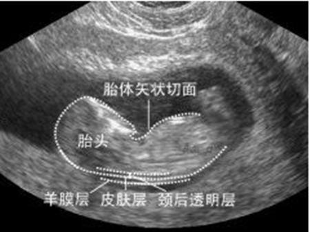 孕期检查那么重要, 这4项最重要! 准妈妈们做了没
