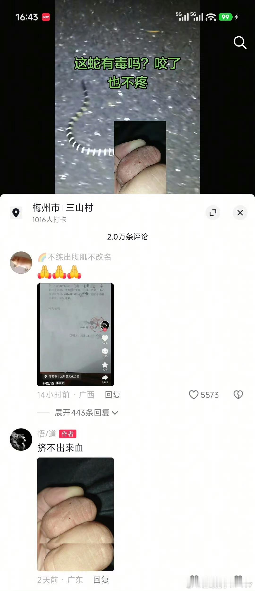 有网友被银环蛇咬了，问评论区有没有毒，看评论区和他最后的签名，估计已经被送走了！