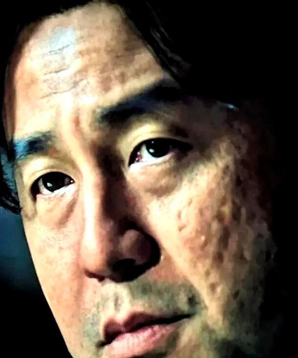 雷佳音你还是别拍电影了，不是你的演技问题，而是你那张满脸橘皮坑洼、浮肿到变形的脸