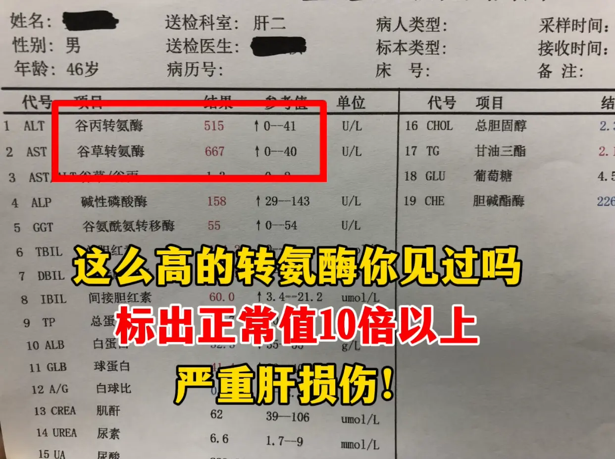 希望大家的肝功能一切正常 这位男士今年40多岁，查出乙肝十多年没放心上...