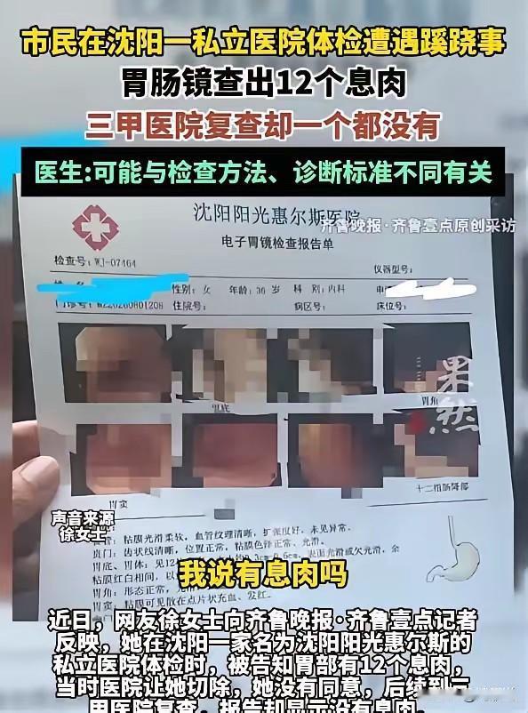肠镜检查12个息肉，告知要做手术否则会咋样咋样，还好这个女士智商在线，这事你刷到