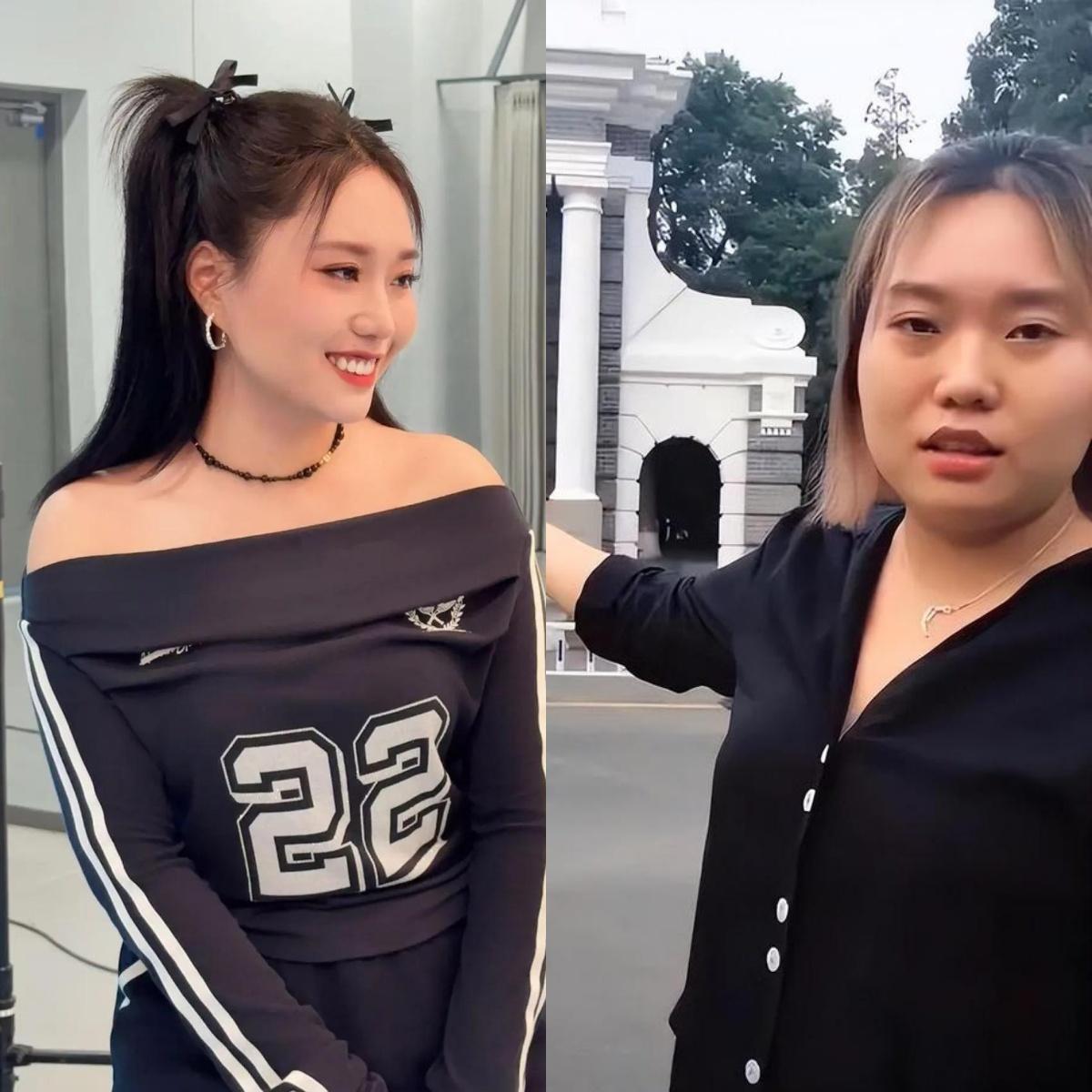 李雪琴一定是医美了！简直是换了个头！我去，简直是太惊人了，李雪琴咋变成这样了？