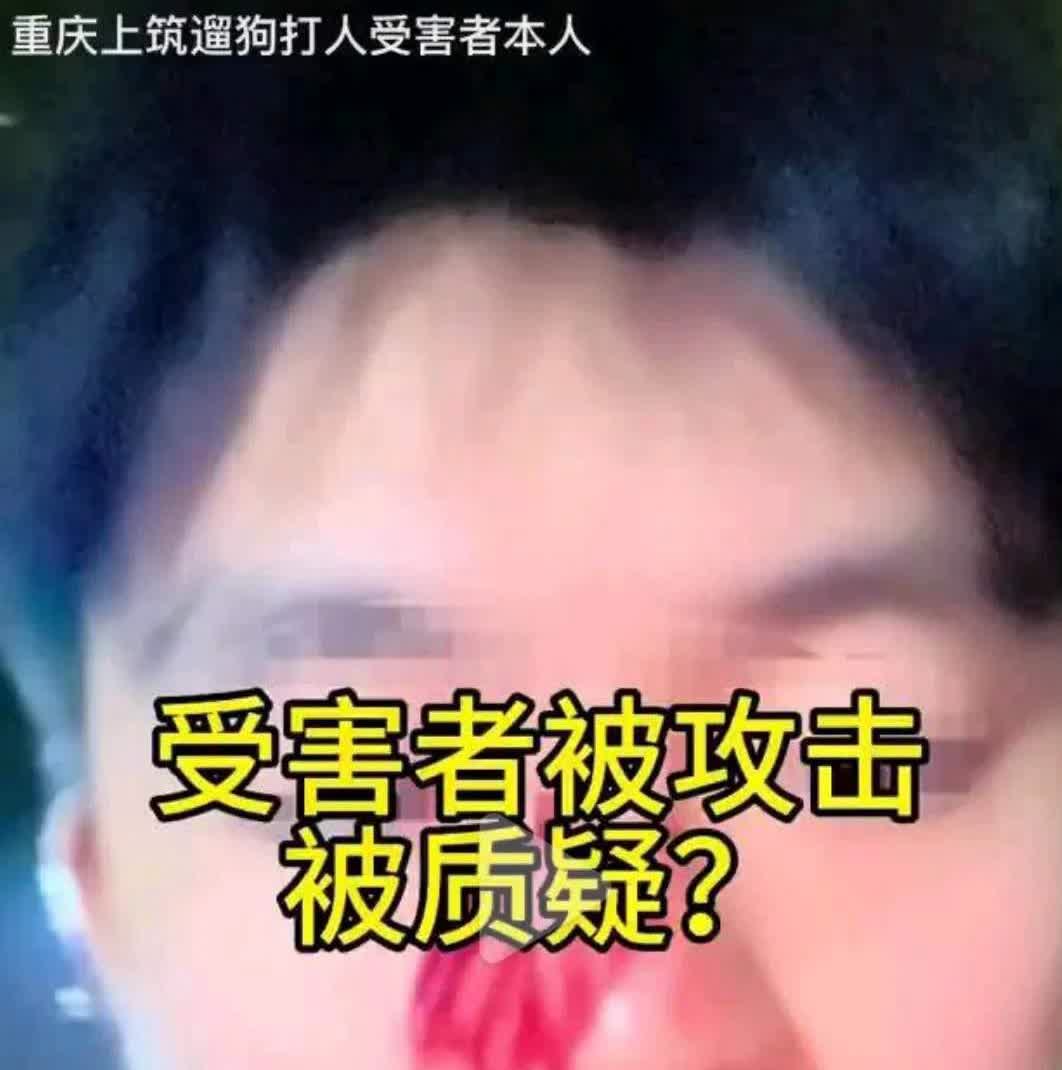 重庆刘先生因在小区质问两名女子遛狗不牵绳反被两名女子殴打，事后，刘先生报警，警方