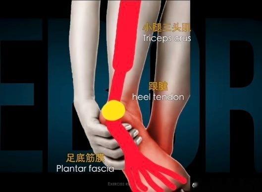 足底筋膜炎刚刚提到了【足底筋膜炎】，发现很多朋友还是会直接用筋膜球，而且是越痛
