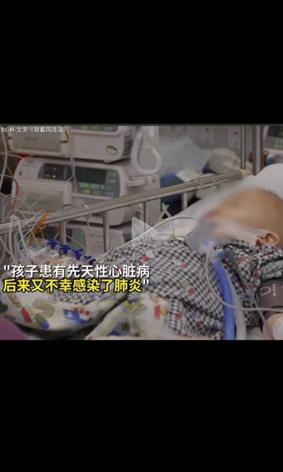 这个孩子患有先天性心脏病，后来又不幸感染了肺炎，全身插满管子，靠呼吸机续命，后来