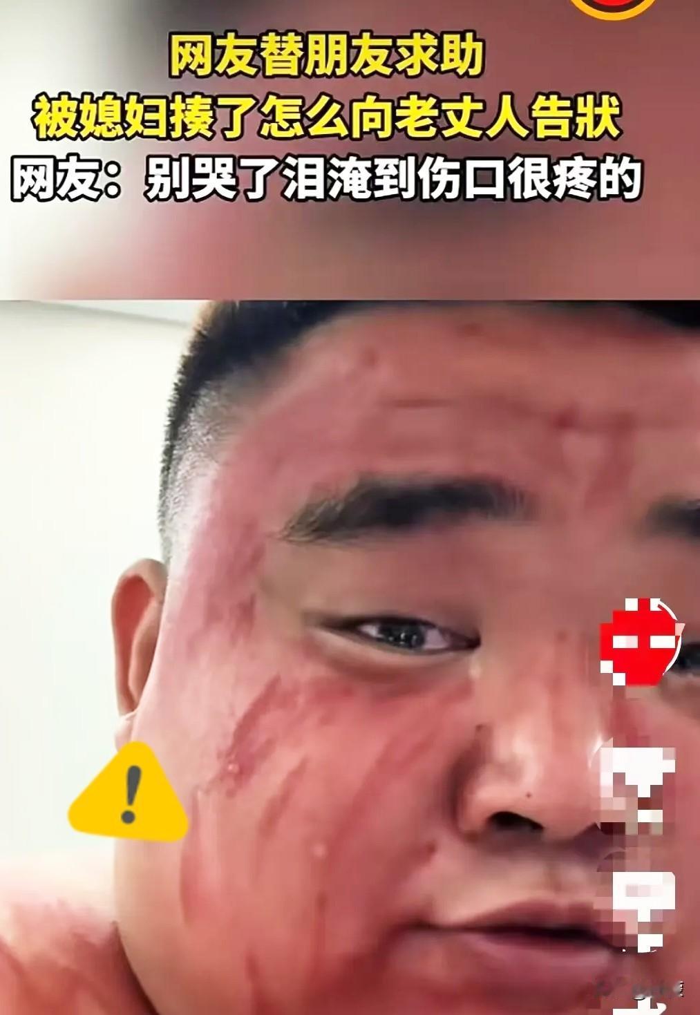 河北有个大哥，被媳妇打了，跑到朋友家哭鼻子，说要去老丈人那儿告状。结果呢，他在朋