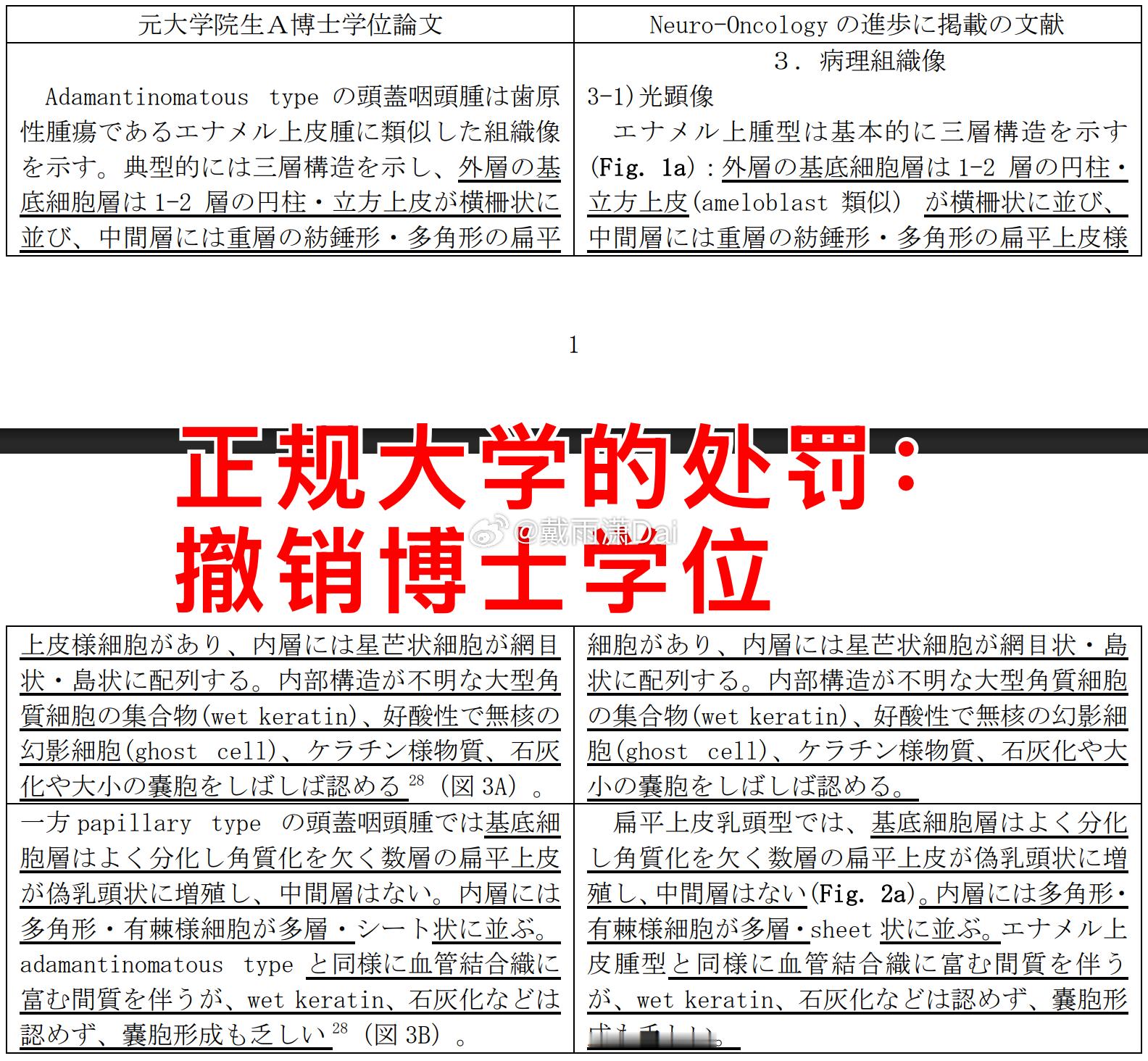 某些国内名校对学术不端的纵容放到全世界都是非常丢人现眼的。关于蒋方舟的硕士论文，