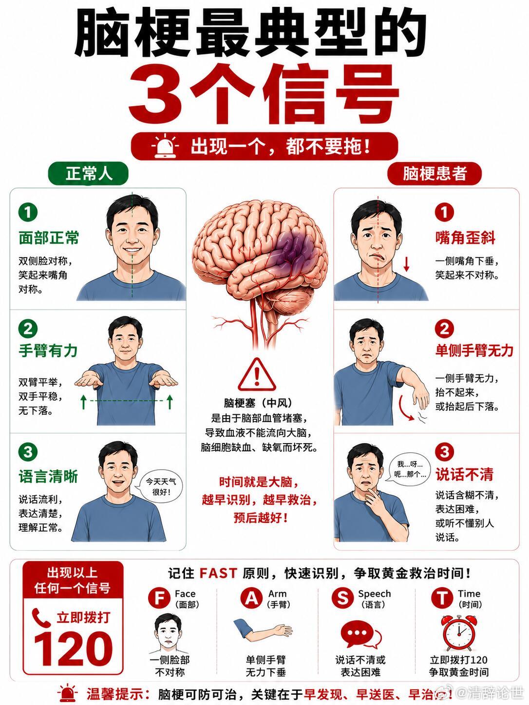脑梗前三天身体发出的预警《脑梗前：8个警报》，脑梗并不一定是突然发生的。很多人在