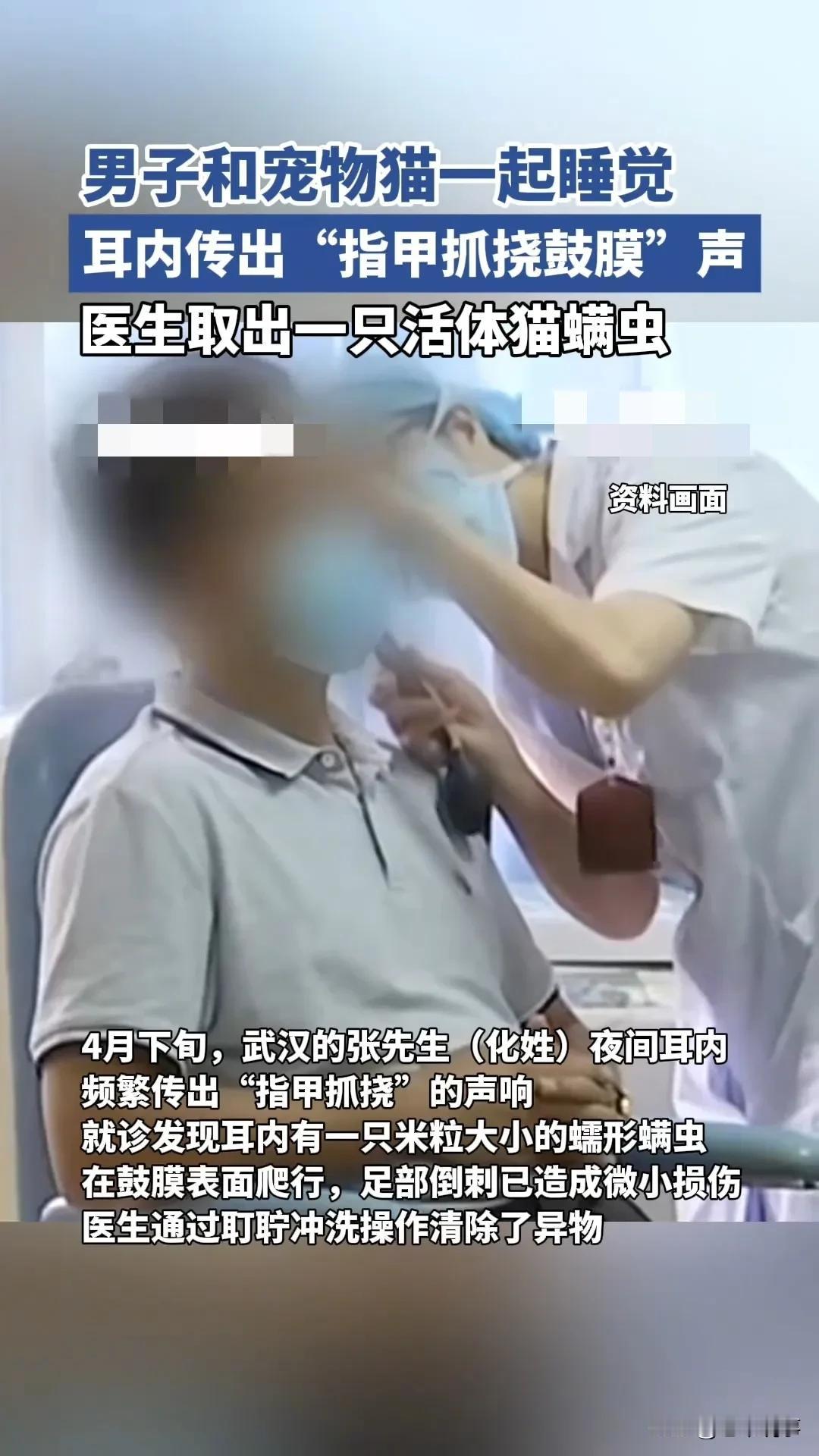 和猫同睡耳朵里传出抓挠声？男子耳道取出活螨虫，养宠人警惕4月下旬，武汉的张