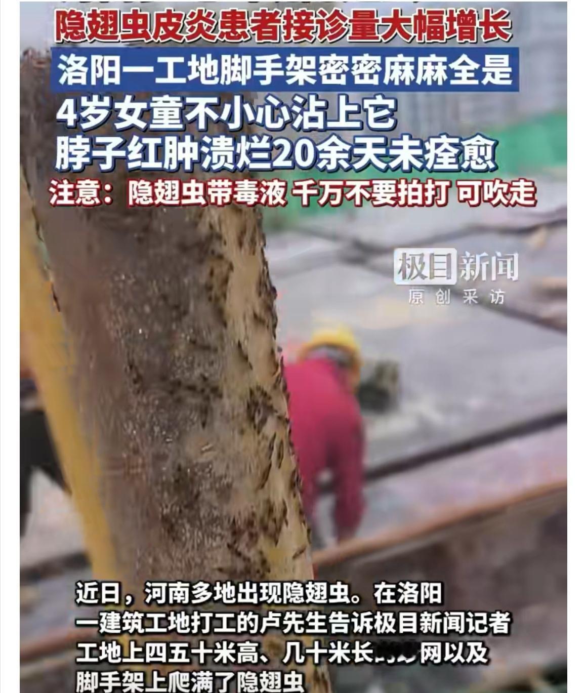 河南多地出现隐翅虫，不少人因此中招，这情况着实让人揪心。想想那南阳女童脖子