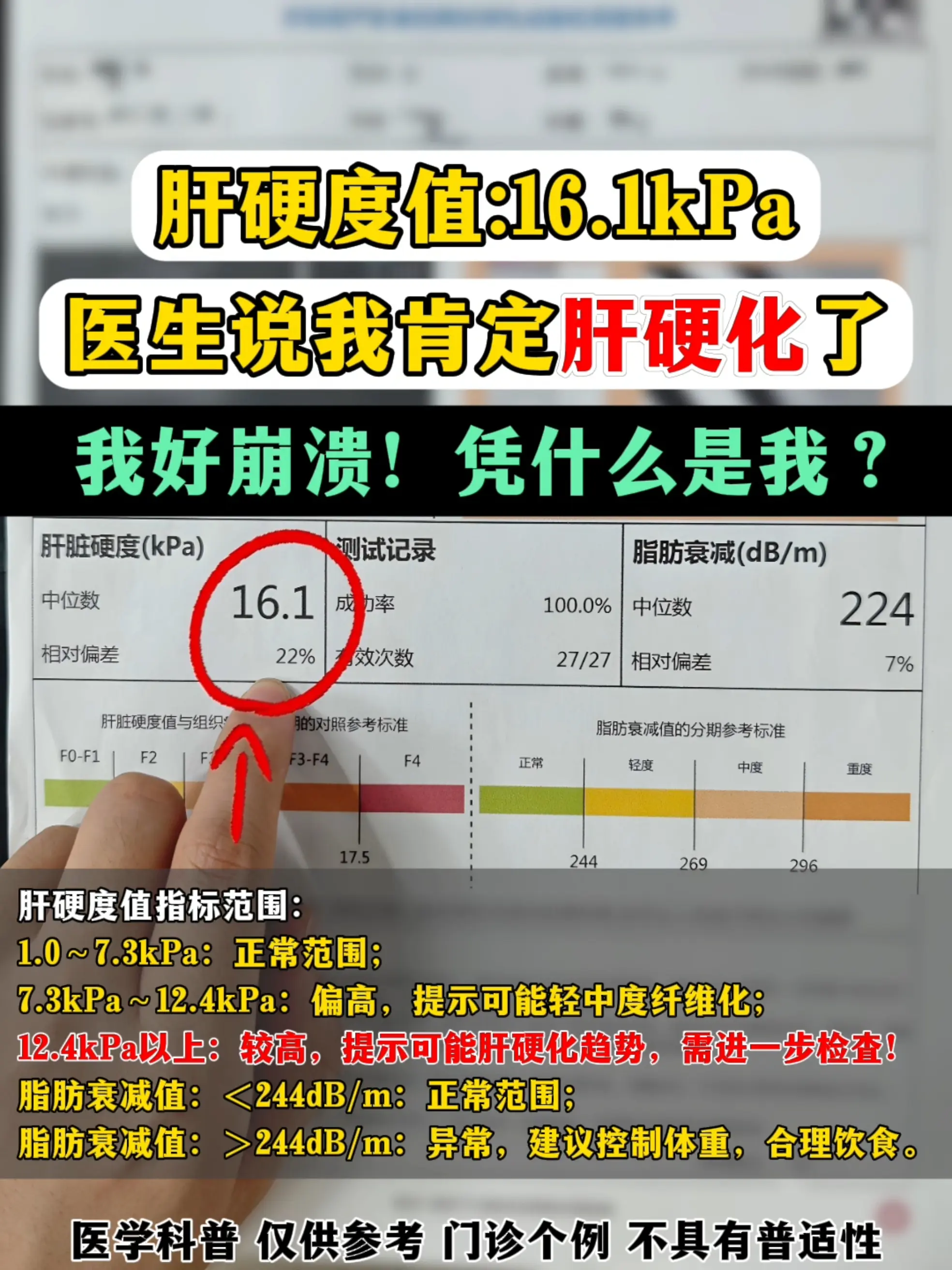 这位粉丝在当地做肝弹查出数值 16.1kPa，被告诉是肝硬化，不敢相信...