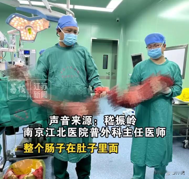 这就是不上厕所的下场！5月22日，南京一40岁男子4个月未排便，医生做手术后从他