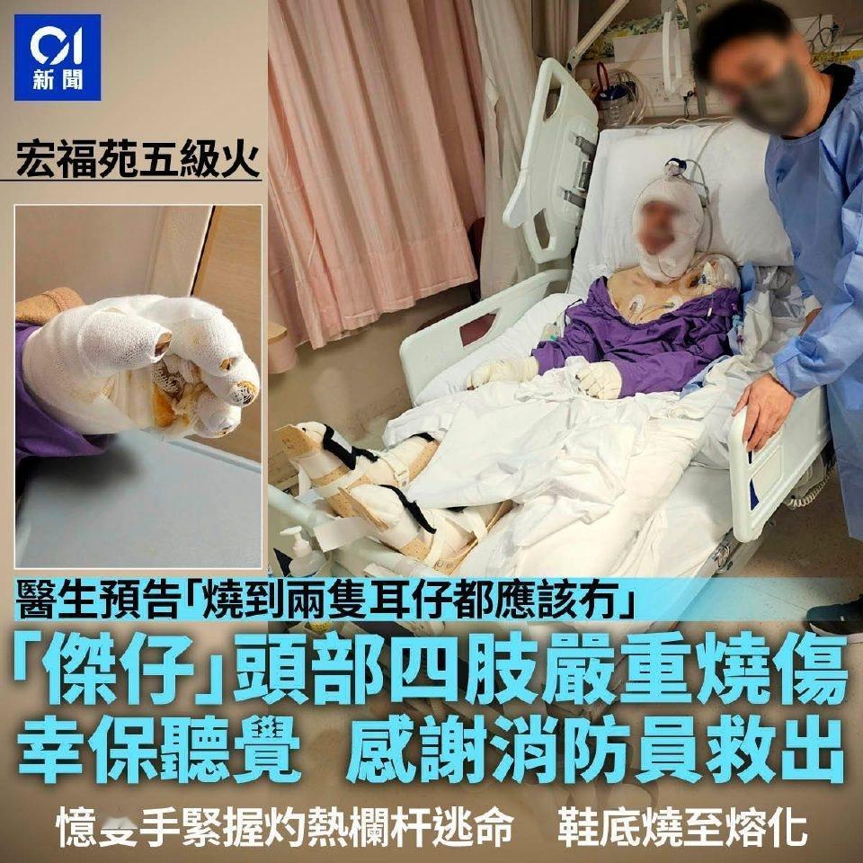 大埔宏福苑五级大火灾造成160人死亡，至今仍然有7人留院，居于宏昌阁的「杰仔」是