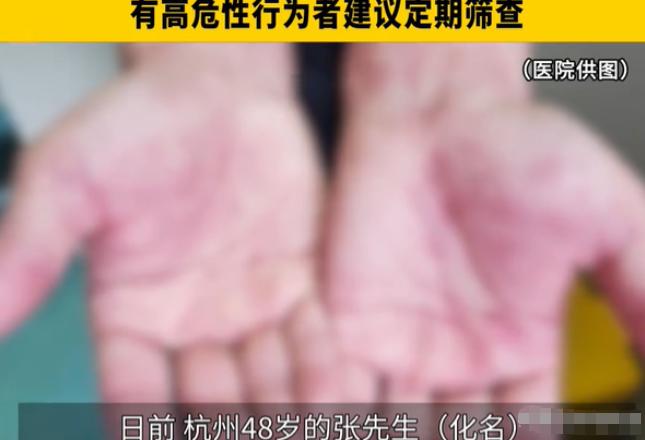 浙江杭州一位男士，之前在外面有过一次没做防护的亲密接触，当时完事了也没太当回事。
