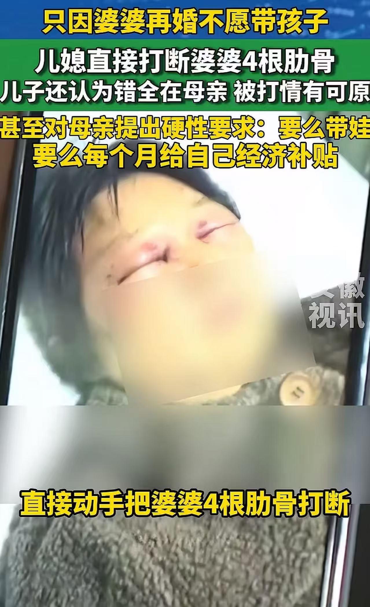 活久见！只因婆婆再婚不愿带孩子，儿媳直接打断婆婆四根肋骨，儿子还认为错全