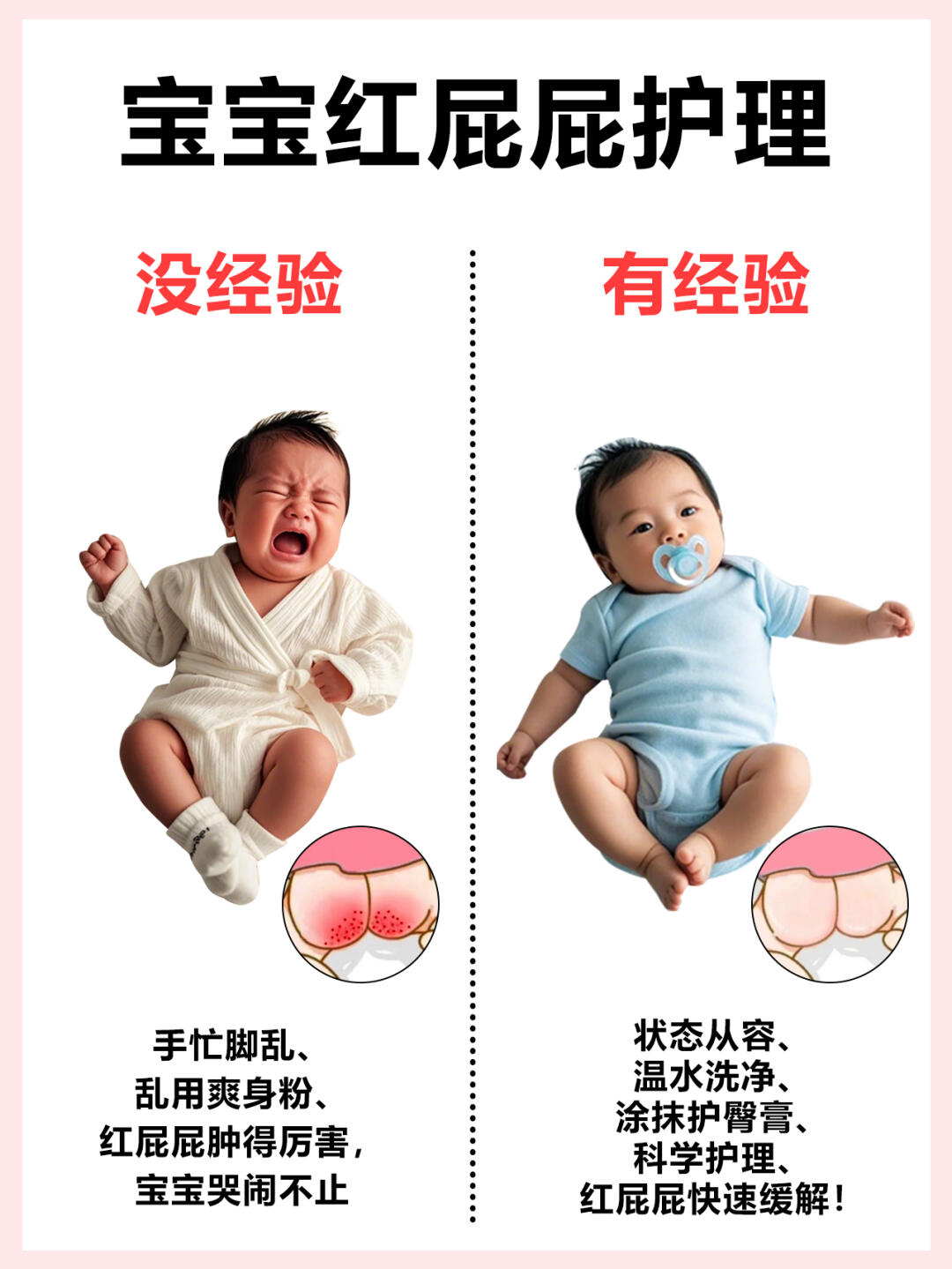 速收藏❗宝宝红屁屁护理和护臀膏用法看这篇