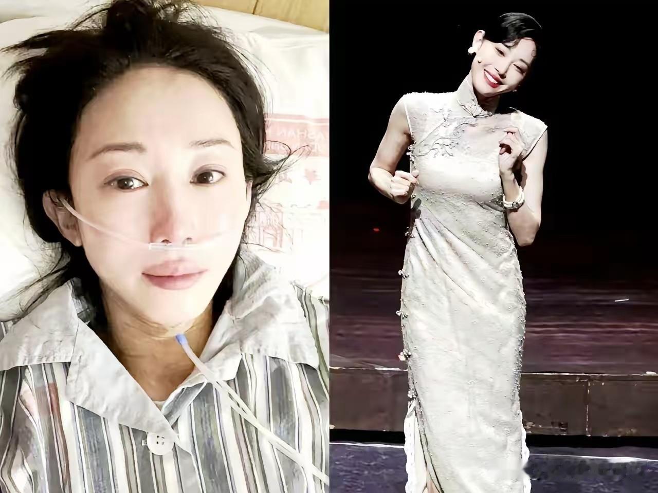 刚去查了朱洁静抗癌的经历。这不查不知道，一查被触动了。癌症线索，是前男友发现的。