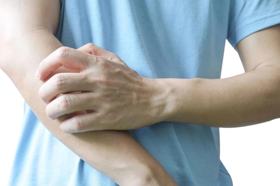 “一进被窝浑身痒”，医生：冬季“干性湿疹”高发，洗澡别超10分钟，最好不要天天洗