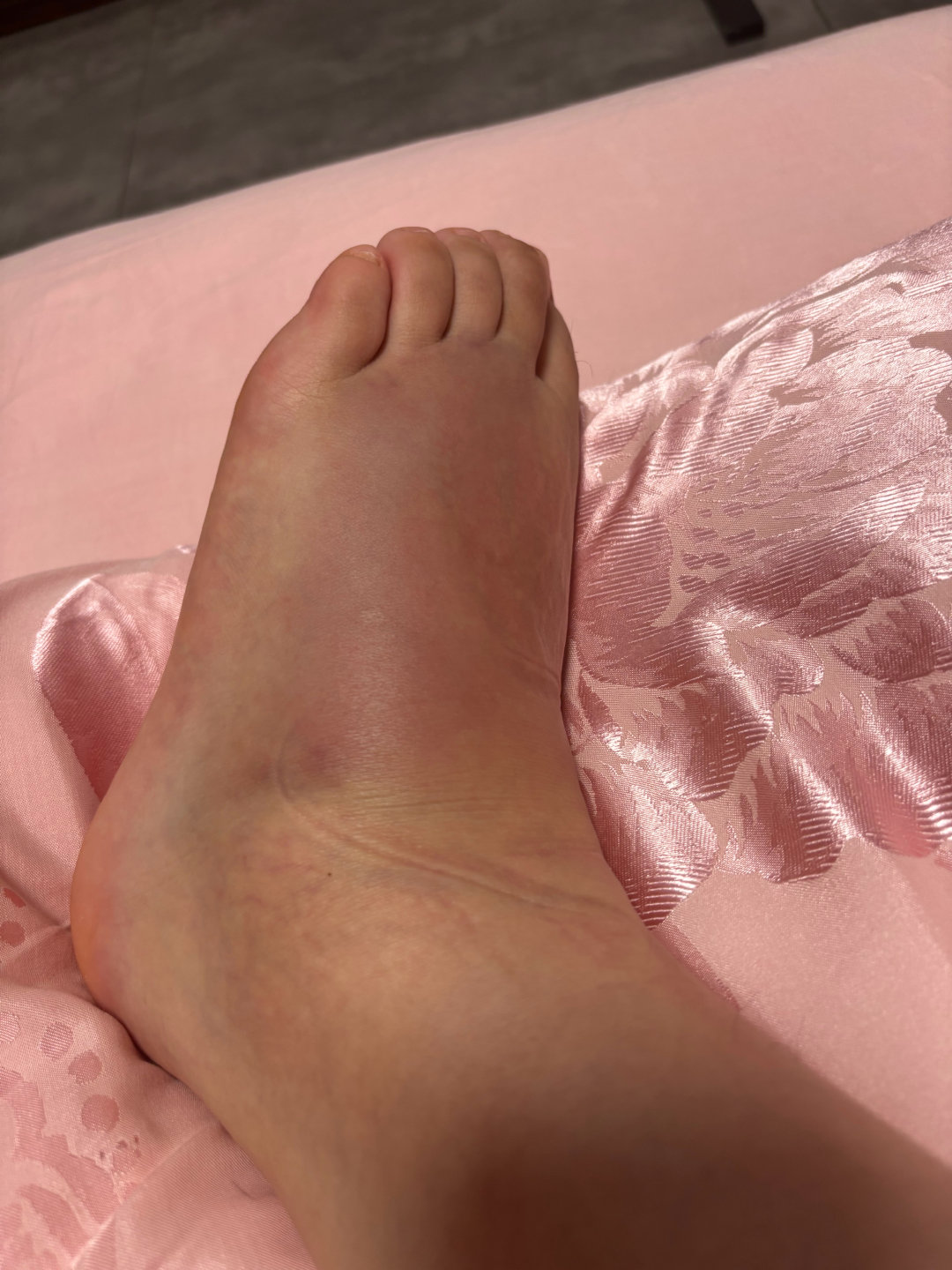 感恩美团京东闪送真的非常快养了一周了继续保持制动​