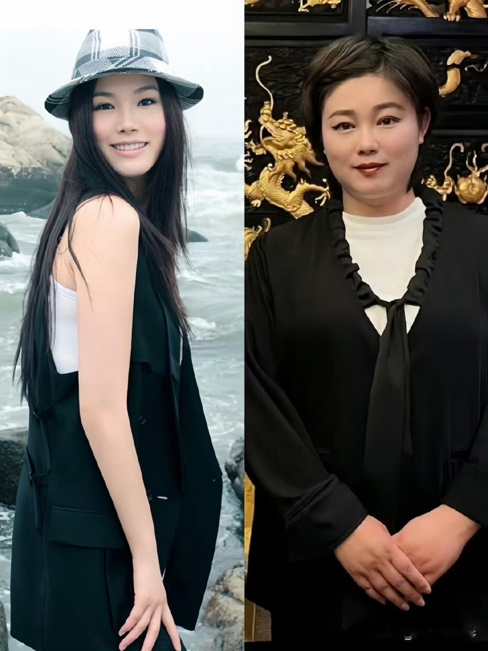 昔日和瞿颖并肩齐名的初代超模于娜，风光一时无人不晓。后来深陷焦虑症，常年靠进食排