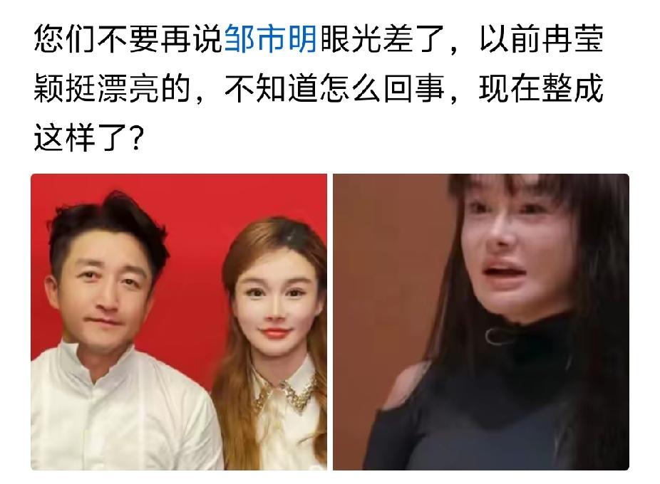 一开始就整过，那时候年轻皮肤还算可以。现在后遗症出来了