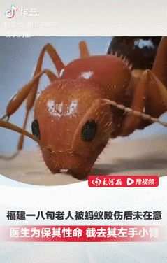 近日，福建莆田，一八旬老人在自家农田里摘花生的时候，不小心被蚂蚁咬了一口，他没有