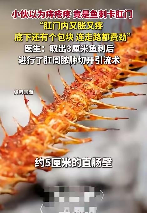 广东，一男子发现自己屁股又胀又疼，还以为是痔疮犯了，就没在意，不料，之后情况越来